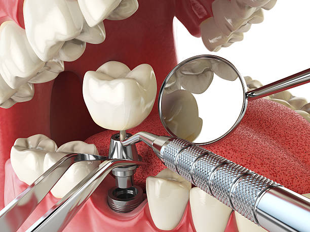 Best Emergency Orthodontic Repairs in Alpine, CA